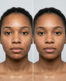 Golden Glow Collection